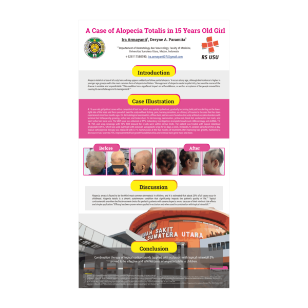 Dermatology dan Venereology Case Report Poster - Alopecia Totalis