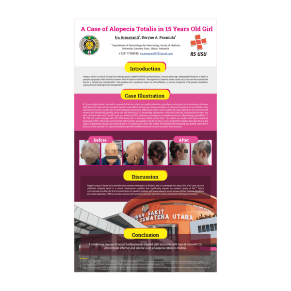 Dermatology dan Venereology Case Report Poster - Alopecia Totalis - Image 2